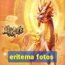 eritema fotos