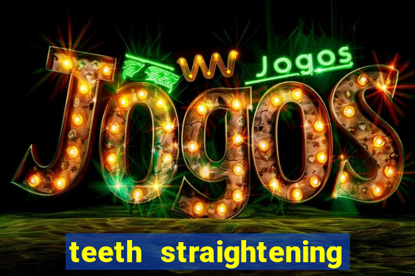 teeth straightening los altos