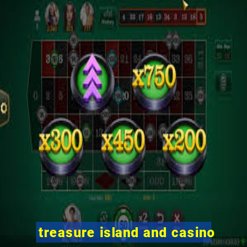 treasure island and casino