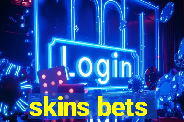 skins bets