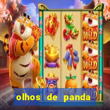 olhos de panda trauma olhos de panda significado